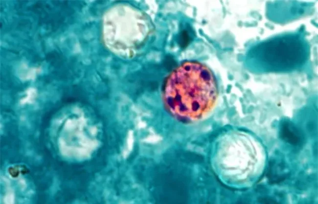 Michigan registra las dos primeras muertes del brote ciclosporiasis en EU