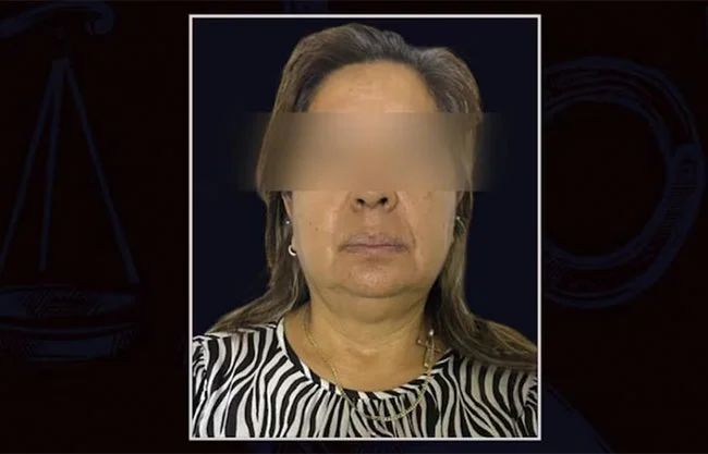 Alicia ‘N’, falsa cirujana que amputó a un paciente, seguirá su proceso en libertad