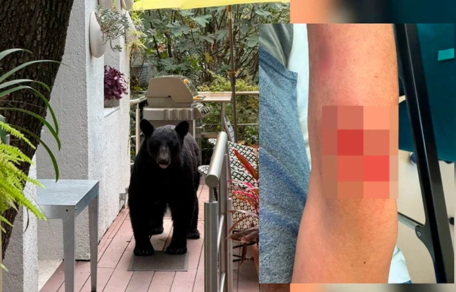 Oso ataca y hiere a un hombre en San Pedro; le provoca herida en el brazo
