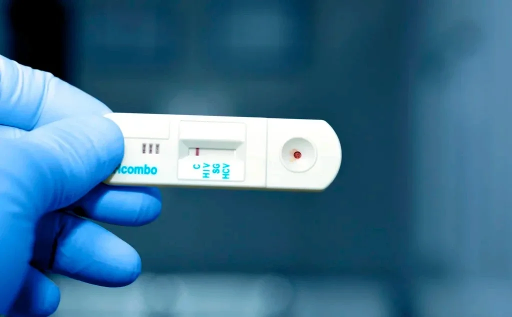 Detectan 183 nuevos casos de VIH en Coahuila durante 2026