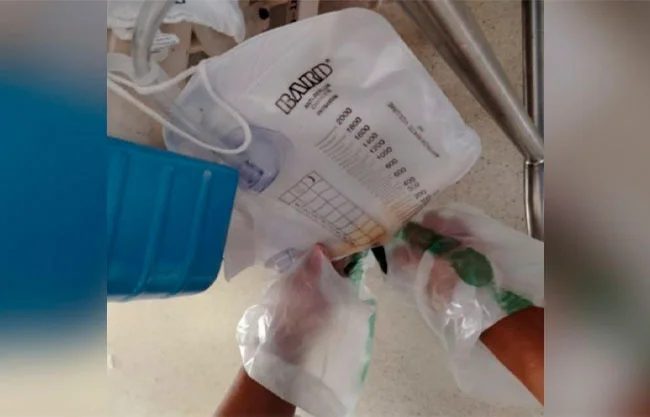 "Es inhumano y miserable": denuncian bolsas de plástico como guantes en hospital de Veracruz
