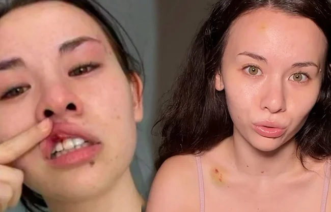 La influencer María Reus Huang es agredida por dos seguidoras en plena calle