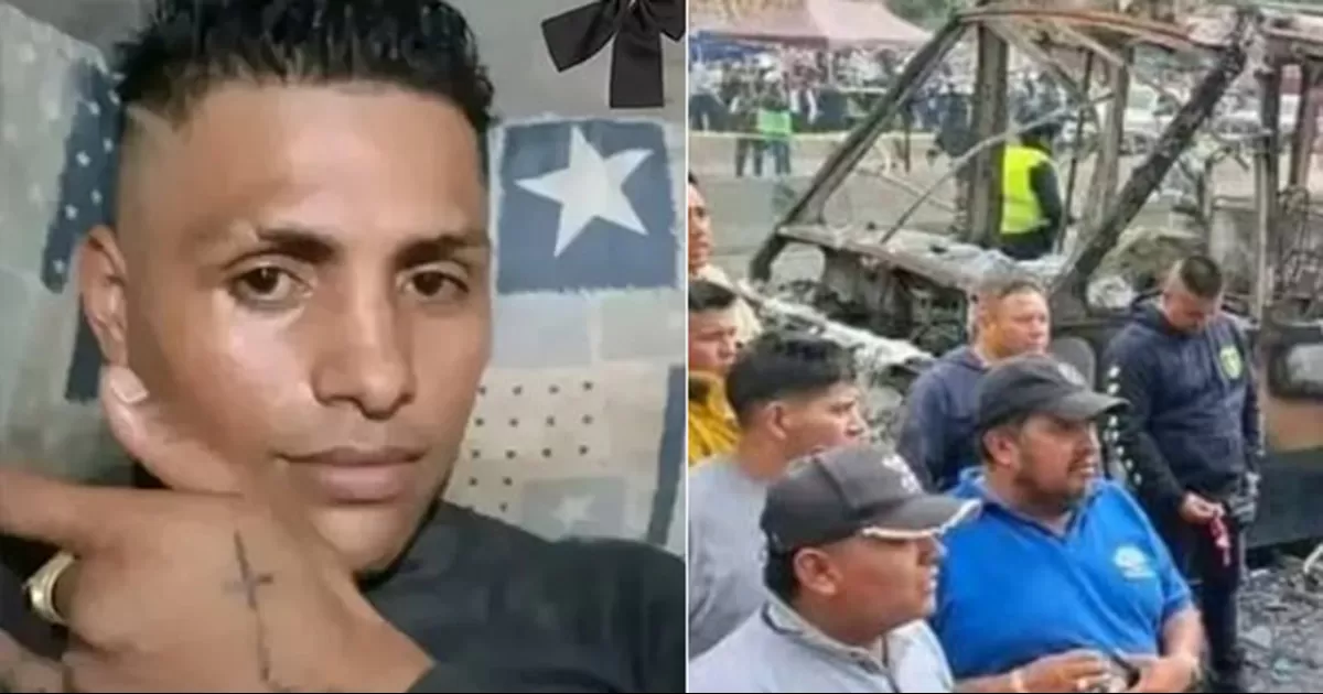 Erick permaneció 10 días en el hospital General Rubén Leñero con quemaduras severas en el 100 por ciento de su cuerpo