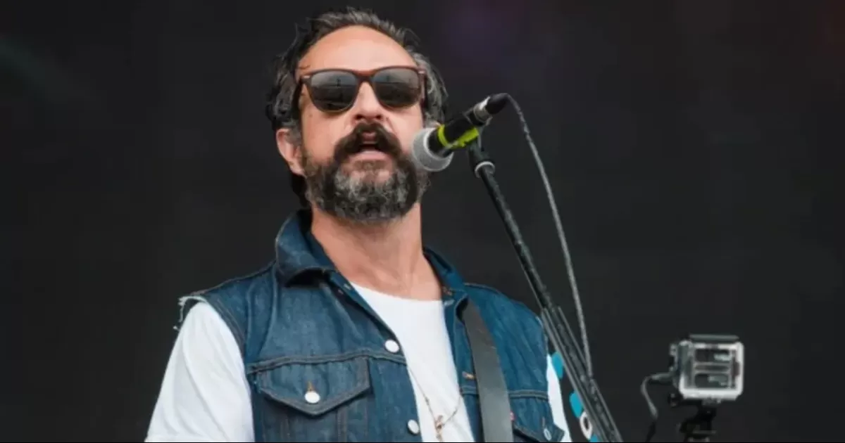 Tito Fuentes de Molotov muestra cómo quedó su rostro tras 11 cirugías y estar en coma por adicciones