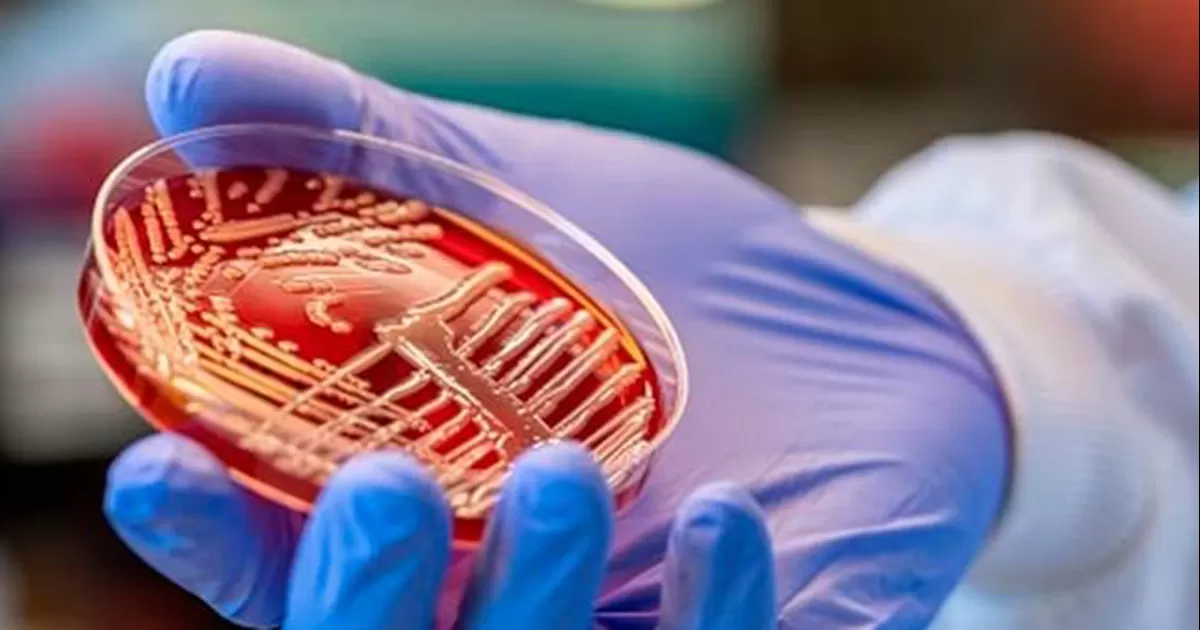 Klebsiella oxytoca es una bacteria gramnegativa, aerobia y con forma de bastÃ³n, perteneciente al gÃ©nero Klebsiella.