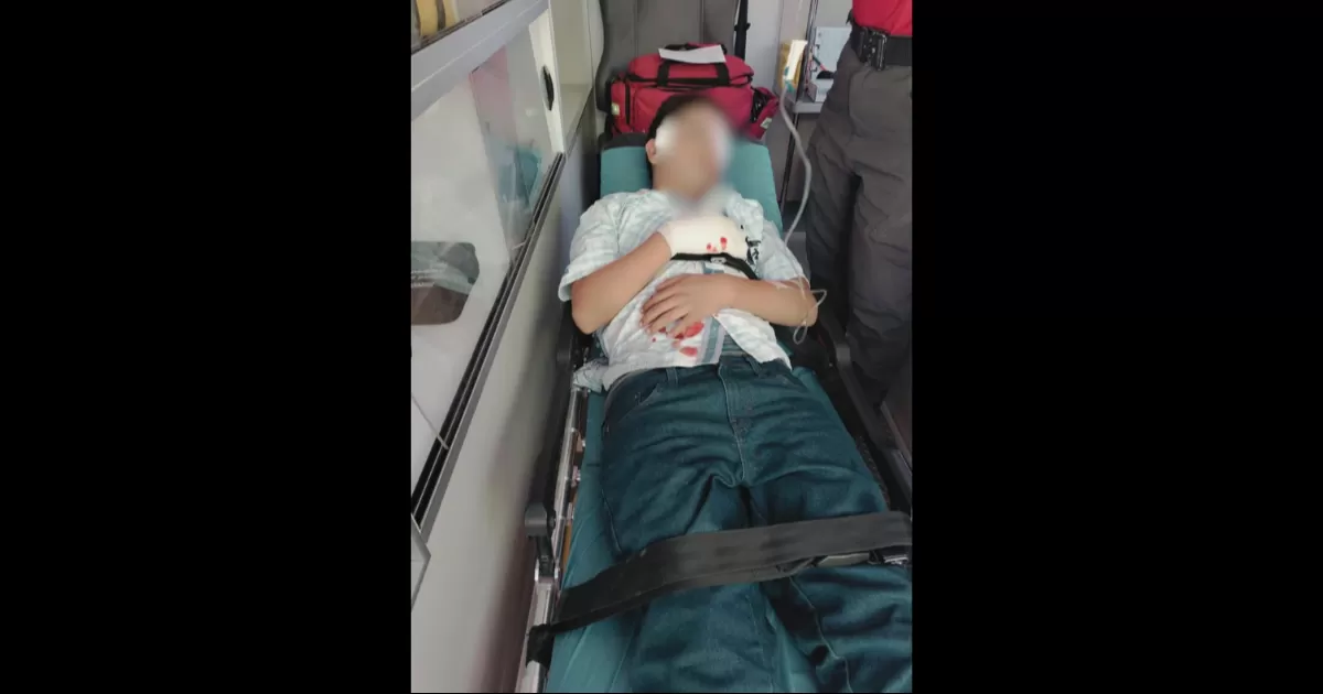 Le explota petardo a niño en pleno festejo navideño, temen que pierda un ojo