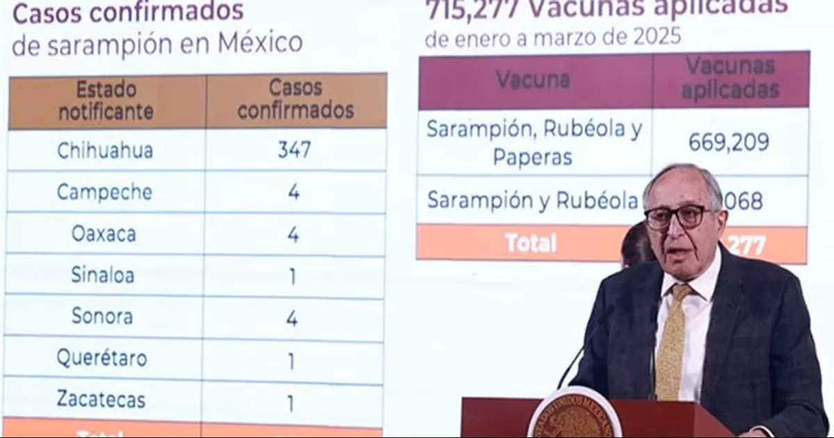 La SecretarÃ­a de Salud reportÃ³ 362 casos de sarampiÃ³n en MÃ©xico, de los cuales 347 se han dado en Chihuahua